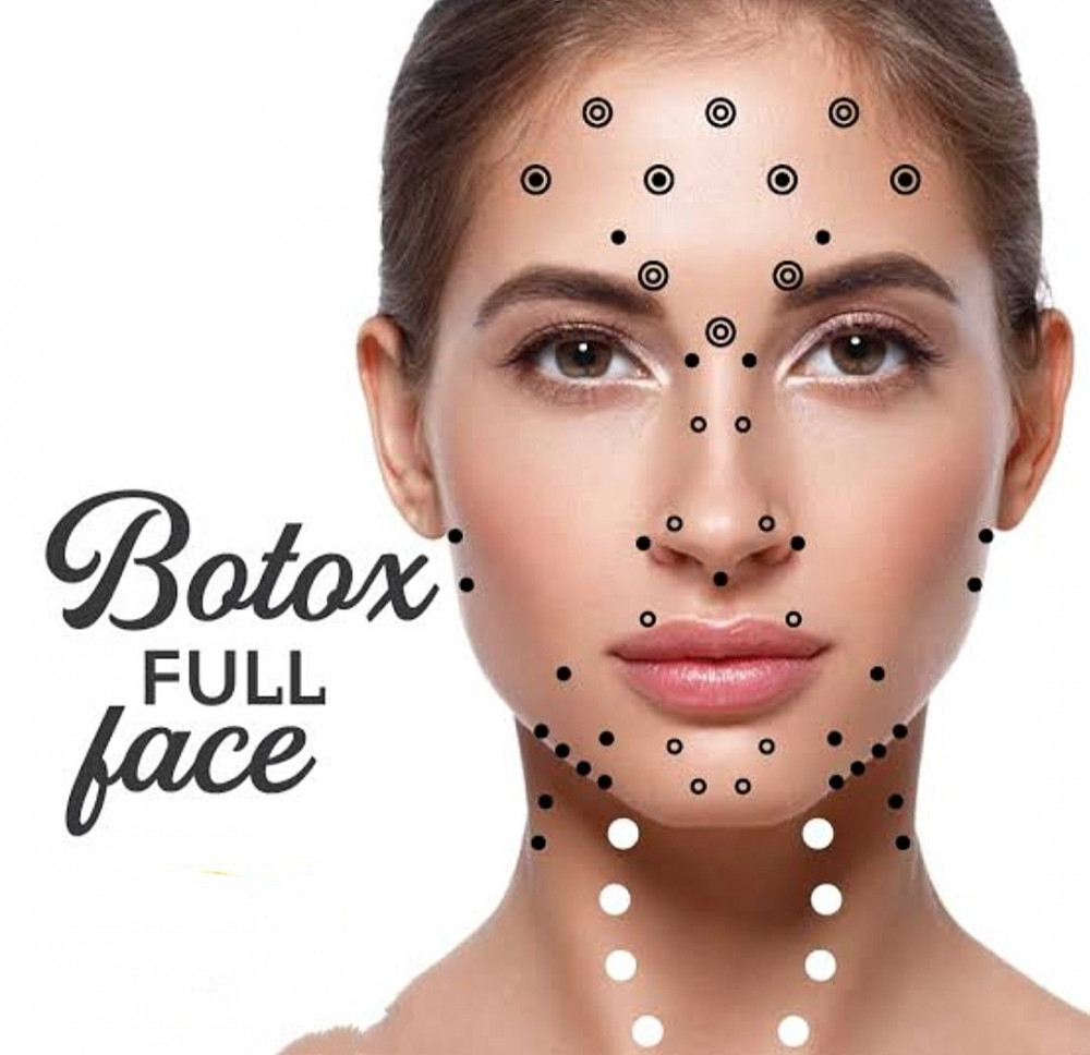 Botox Toxina Botulínica harmonização facial Guará Brasília